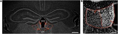 Multi-level variations of lateral habenula in depression: A comprehensive review of current evidence